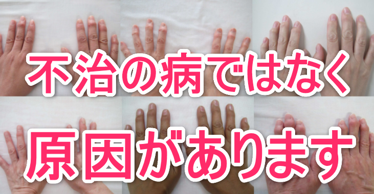 へバーデン結節の痛みに対する効果的な指の揉み方 施術法とは 東京都杉並区の整体は三起均整院